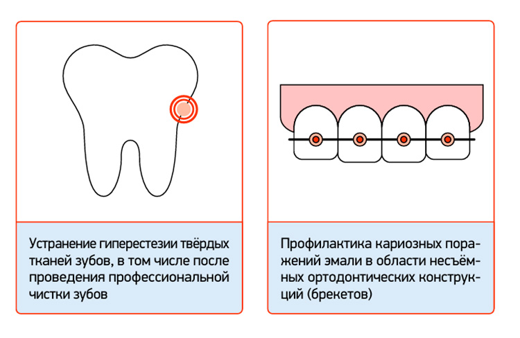 СМ_Флюор_пр02